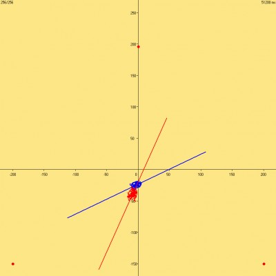 examen stabilométrique