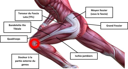 TFL OU SYNDROME DE L'ESSUI GLACE – Douleur genou - Cabinet de ...